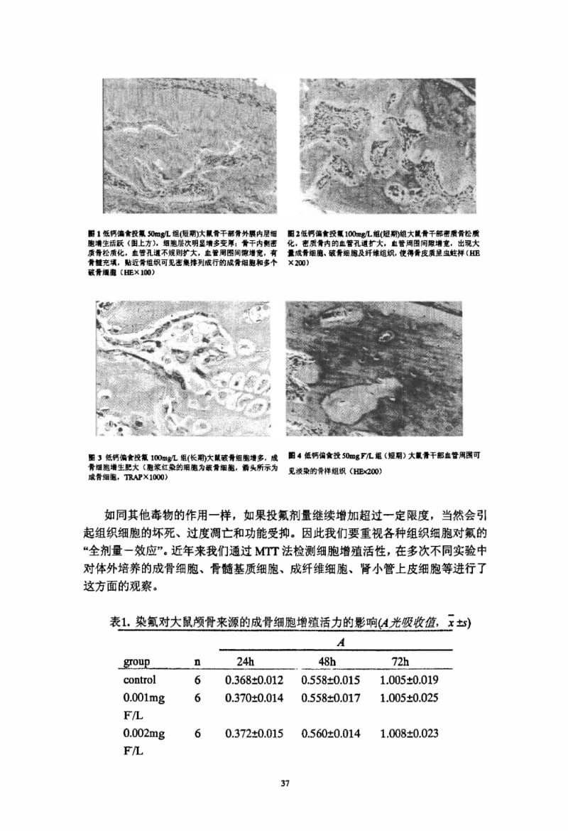地方性氟中毒发病机制的研究进展.pdf_第3页