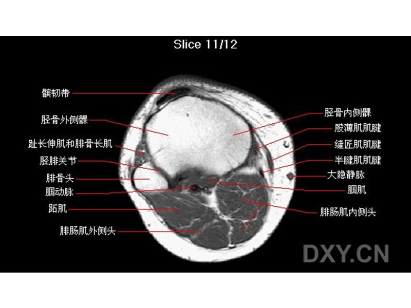 最新《膝部MRI解剖》PPT课件-PPT文档.ppt_第1页