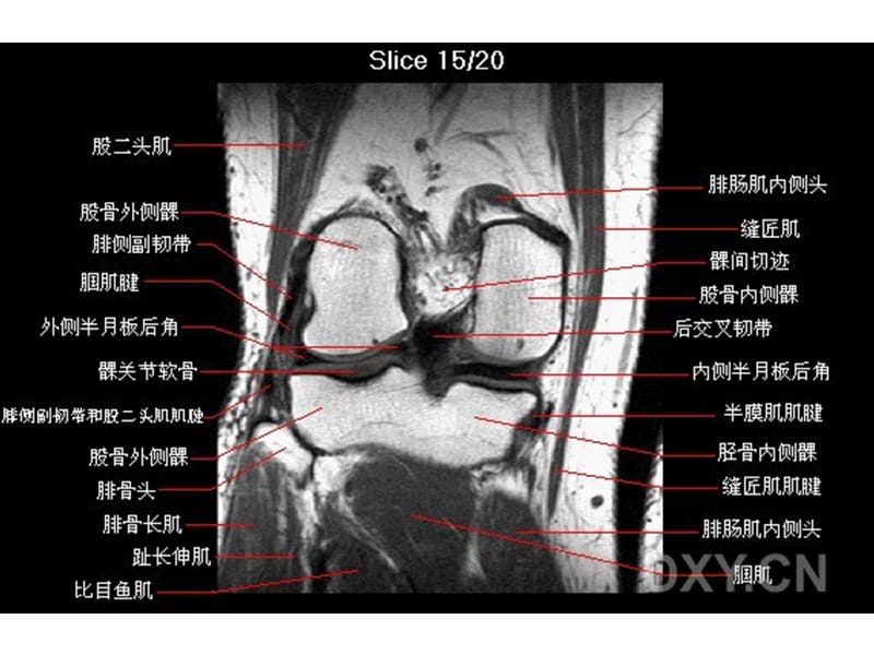 最新《膝部MRI解剖》PPT课件-PPT文档.ppt_第2页