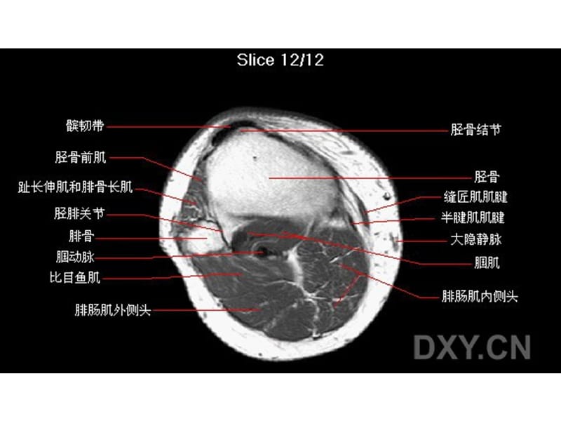 最新《膝部MRI解剖》PPT课件-PPT文档.ppt_第3页