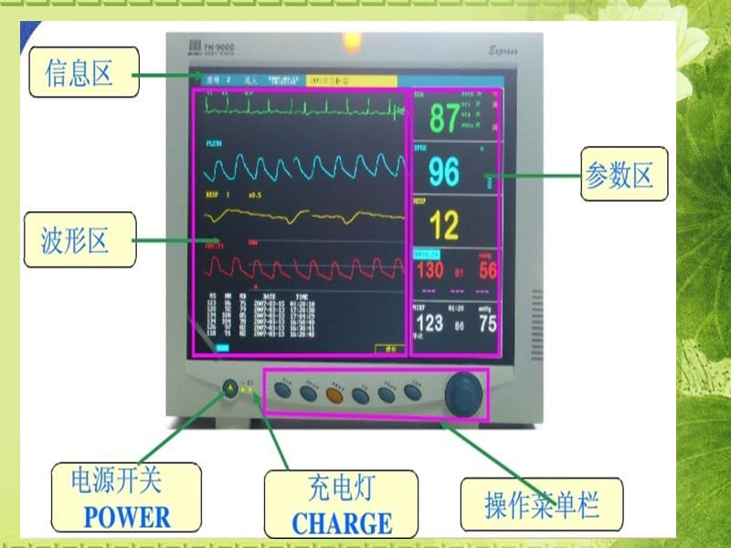 2018年心电监测技术中医护理技术操作规程-文档资料.ppt_第2页