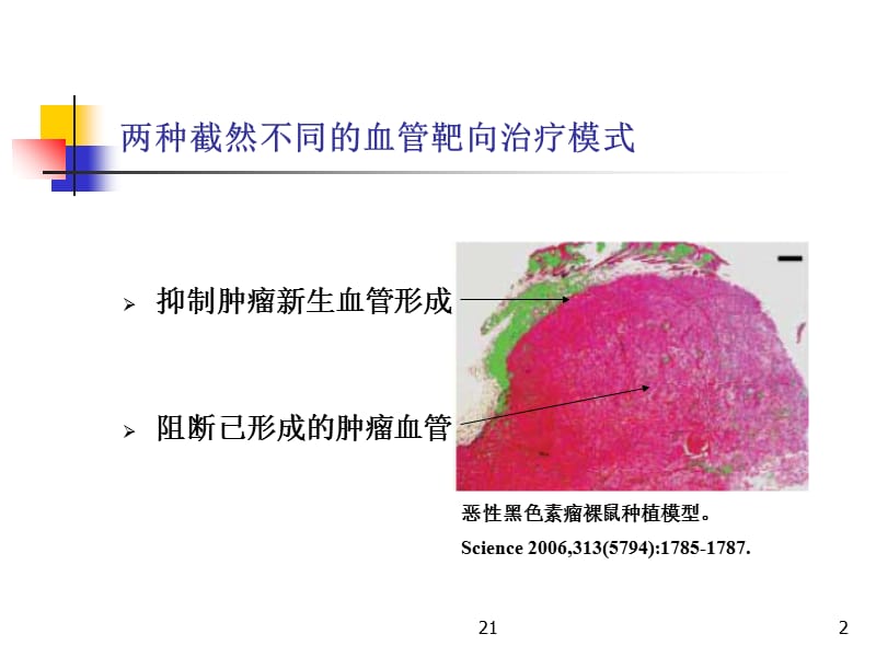 “肿瘤血管阻断剂”一类崭新的肿瘤血管靶向治疗药物-文档资料.ppt_第2页