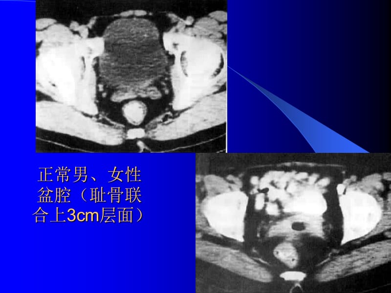 2018年腹腔及腹膜后CT诊断2ppt课件-文档资料.ppt_第2页
