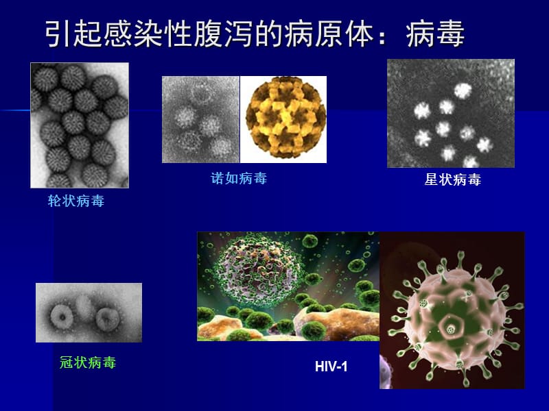 感染病学（上海交通大学）霍乱-文档资料.ppt_第3页