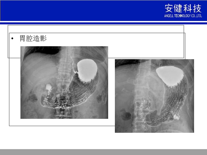 数字化放射医疗技术对中医系统临床诊断与治疗重要意义分析-PPT文档.ppt_第3页