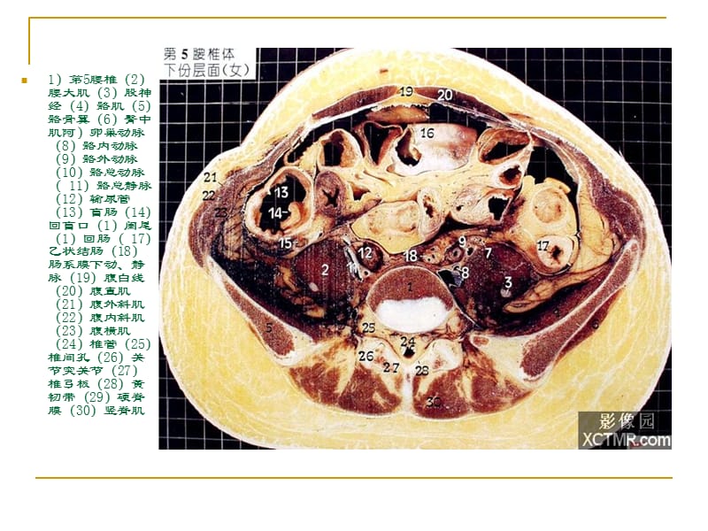 人体断层解剖图谱盆腔-文档资料.ppt_第2页