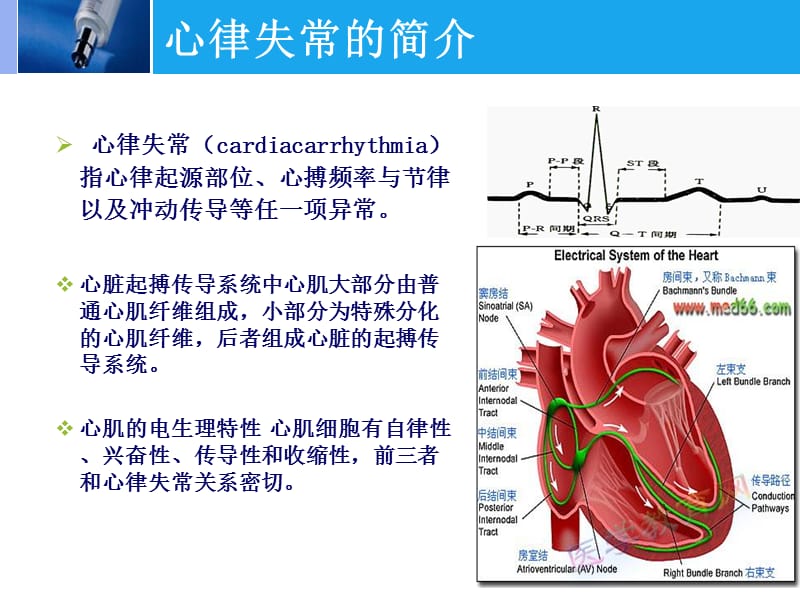 射频消融术的护理-精选文档.ppt_第3页