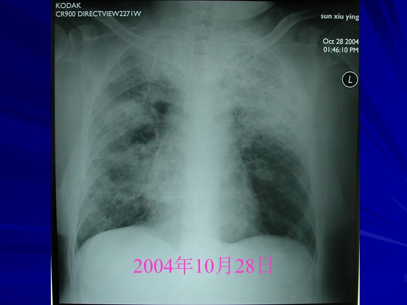 最新院内感染的细菌耐药问题及抗生素应用策略-PPT文档.ppt_第2页