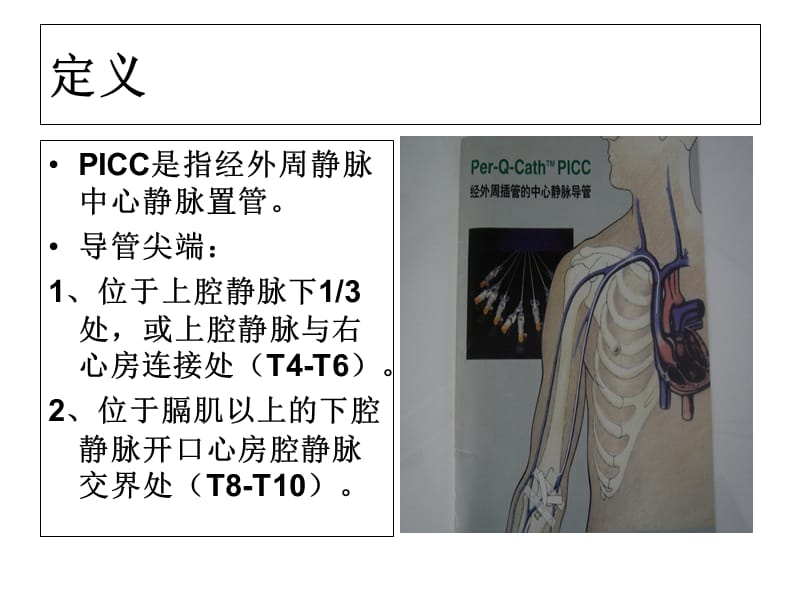 新生儿PICC置管及护理-文档资料.ppt_第2页