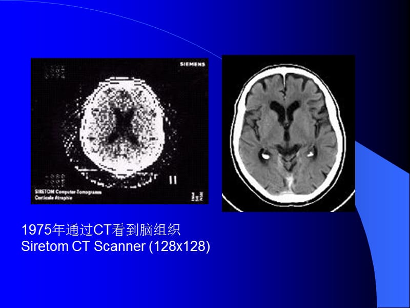 最新：头颅CT课件-文档资料.ppt_第1页