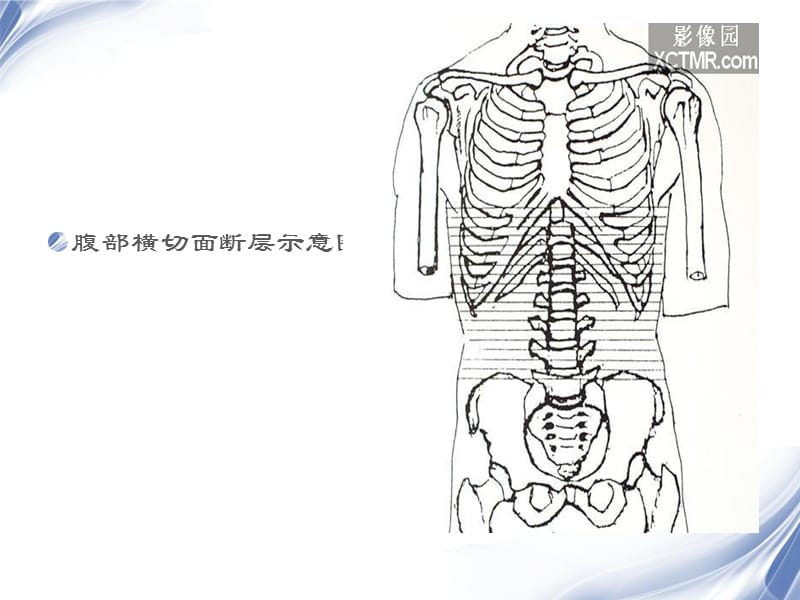 最新人体断层解剖图谱腹腔-PPT文档.ppt_第1页
