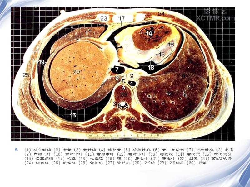 最新人体断层解剖图谱腹腔-PPT文档.ppt_第3页