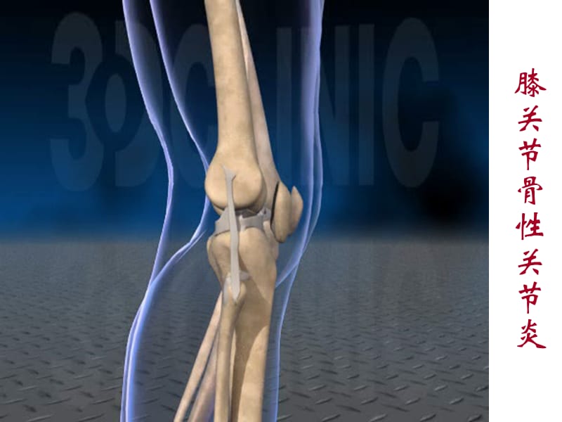 膝关节运动学0.ppt_第3页