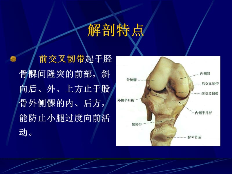 膝关节交叉韧带损伤.ppt_第2页