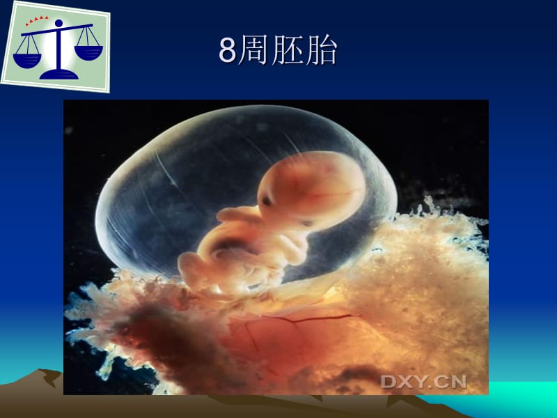 胎儿生长受限的诊疗.ppt_第3页