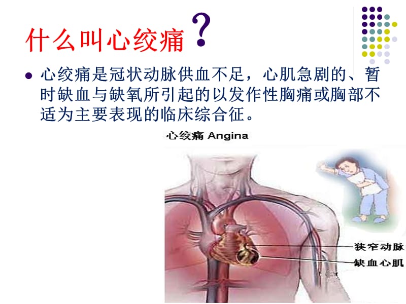 心绞痛的急救.ppt_第3页