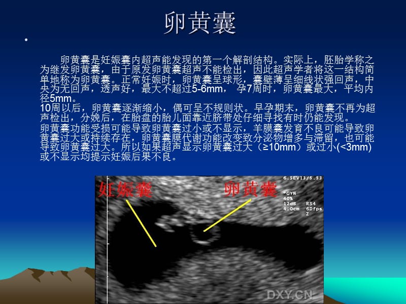 胎儿正常超声表现王晋连云港.ppt_第3页