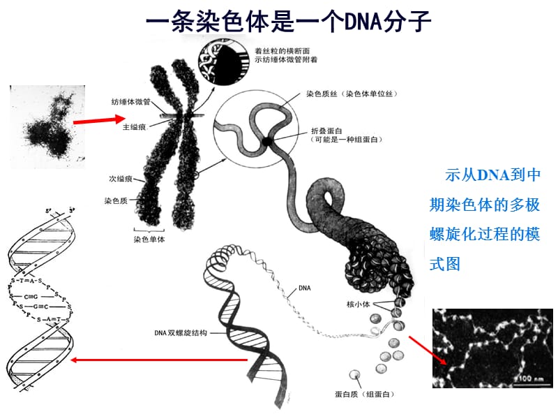 染色体病-1(2012).ppt_第3页