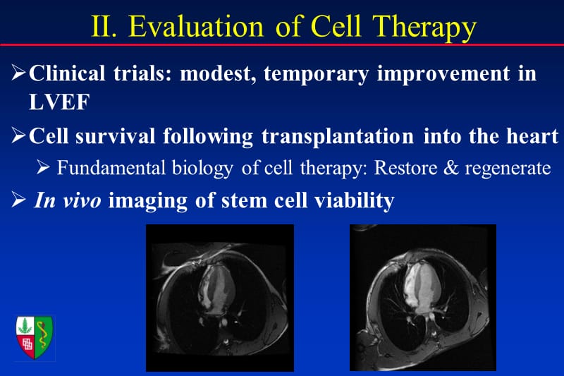 在体干细胞生物显像和心肌修复.ppt_第3页