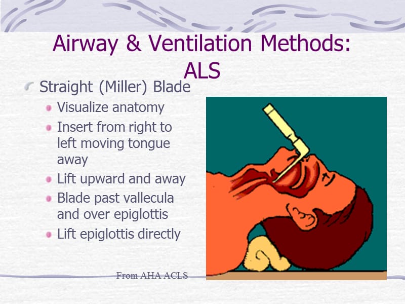 呼吸道通气方法 ALS3.ppt_第2页