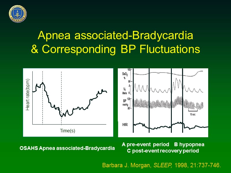 睡眠呼吸暂停相关心动减缓与晨起血压的关联性研究(英文）.ppt_第3页
