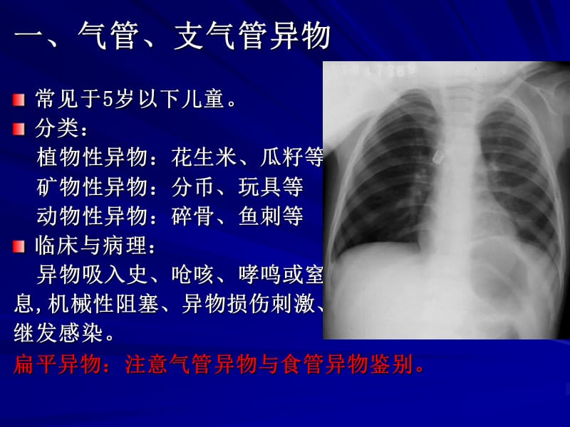 呼吸系统常见疾病影像诊断PPT课件.ppt_第2页