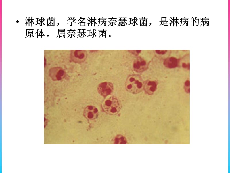 淋球菌适宜临床检验技术介绍.ppt_第3页