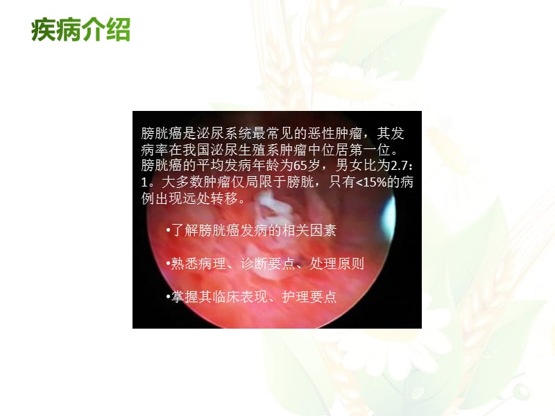 膀胱癌的护理ppt课件.ppt_第2页