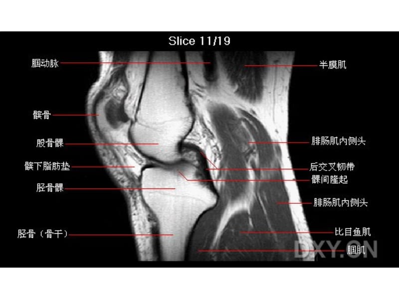 2019膝部MRI解剖.ppt_第1页