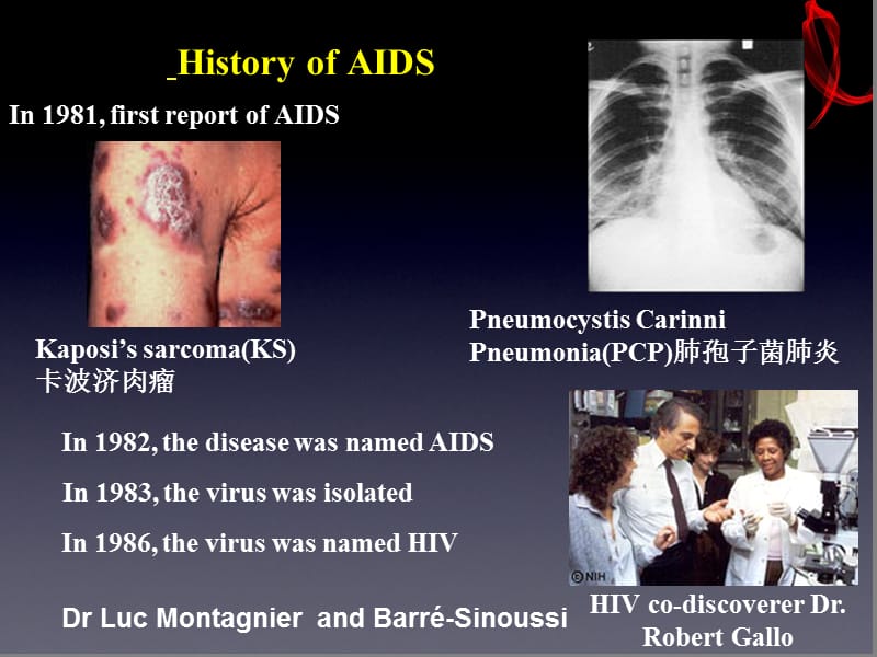 《艾滋病-》ppt课件.ppt_第3页
