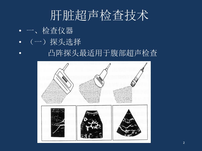 《讲课肝脏超声》ppt课件.ppt_第2页