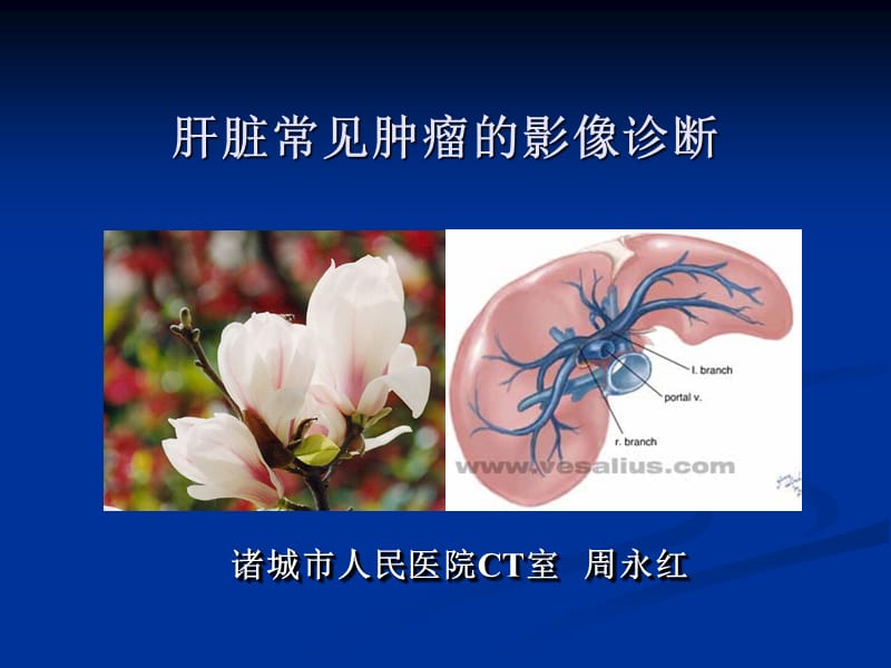 肝脏肿瘤的影像诊断pp阳t课件.ppt_第1页