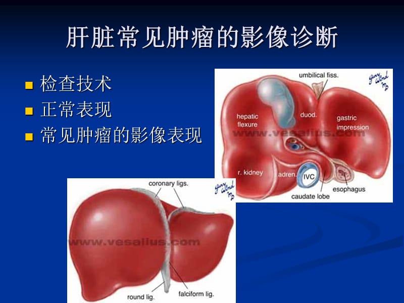 肝脏肿瘤的影像诊断pp阳t课件.ppt_第2页