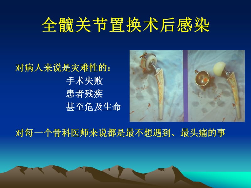 髋关节置换中术后感染的诊断和治疗ppt课件.ppt_第2页