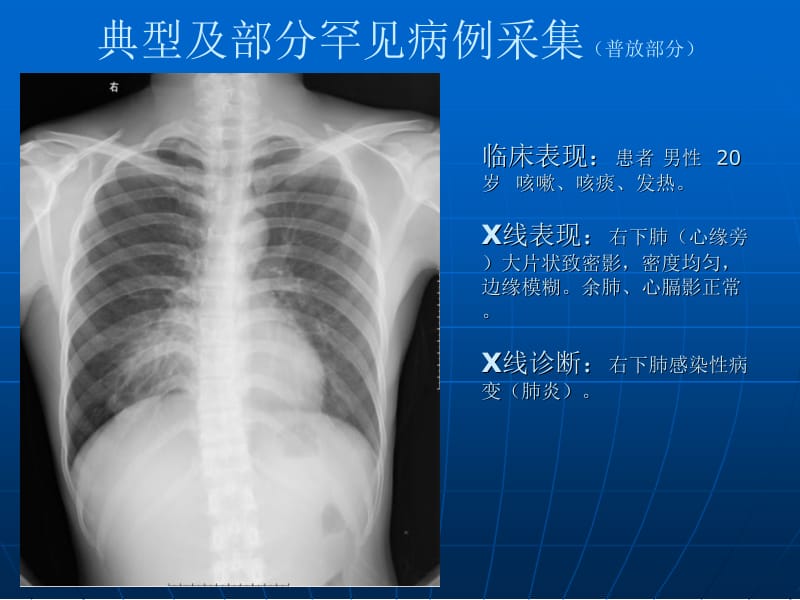 典型及部分罕见病例采集 (2).ppt_第2页