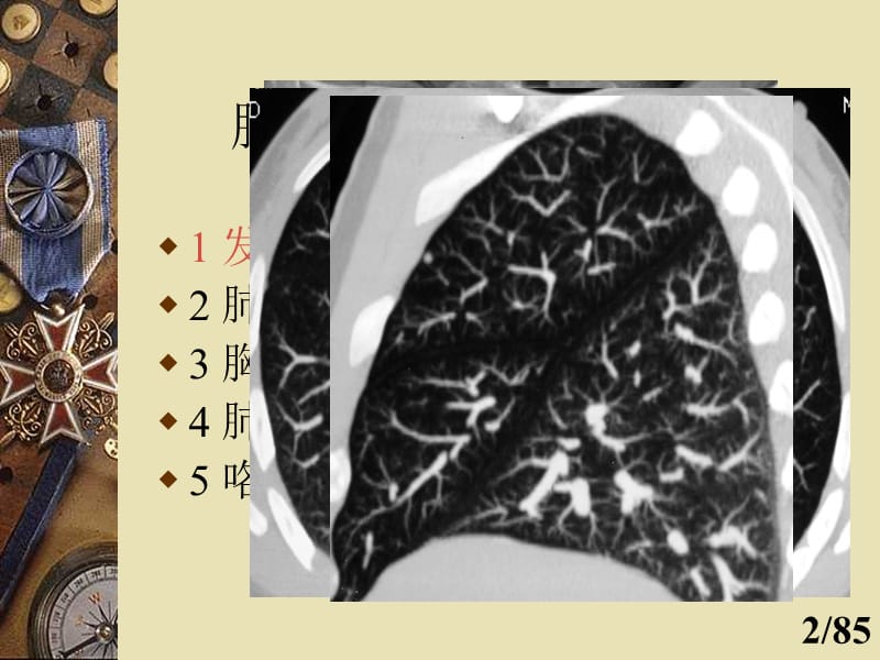肺部CT诊断.ppt_第2页