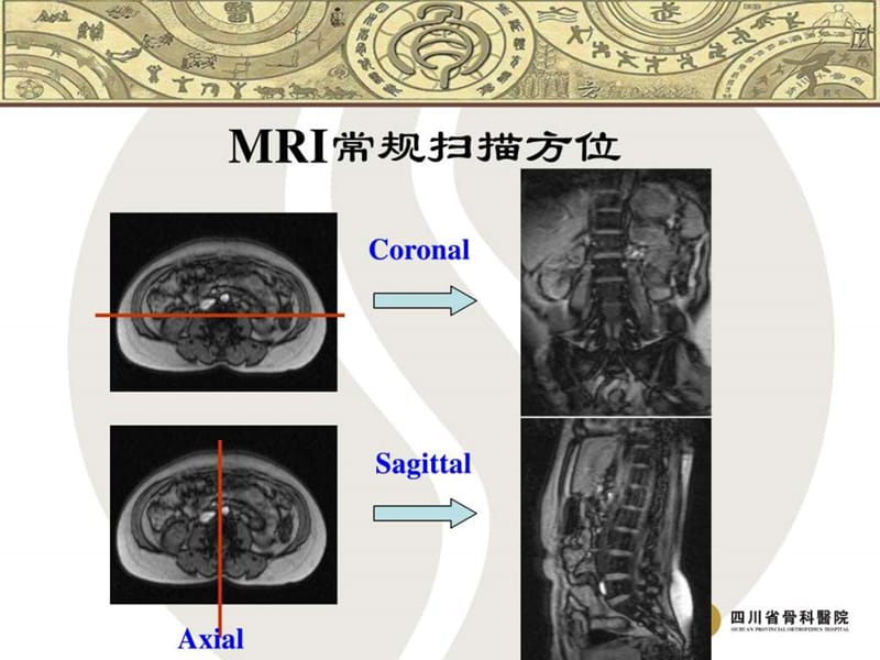 脊柱常见疾病的MRI诊断.ppt_第2页