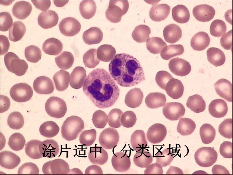 血细胞图谱大全.ppt_第2页