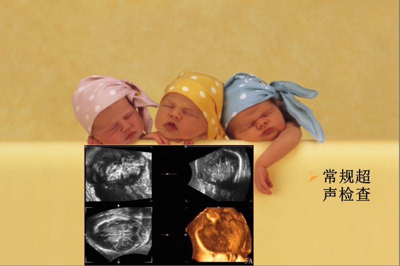 MRI对胎儿颅脑检查的作用和临床意义.ppt_第3页