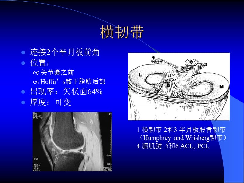 MRI在膝关节创伤的应用.ppt_第3页