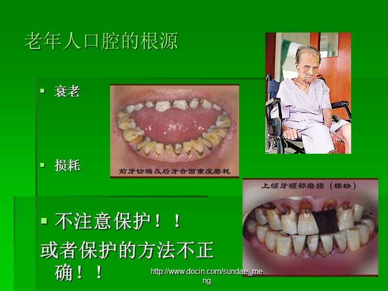 【课件】中老年人的口腔卫生保健.ppt_第3页