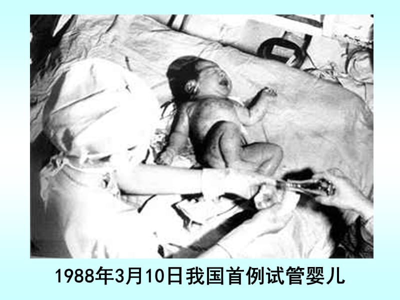 年月日世界上第一个试管婴儿路易斯在英国出生.ppt_第3页