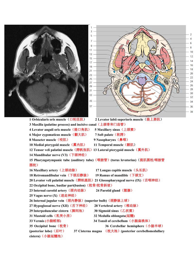 鼻咽部断层解剖图.doc_第1页