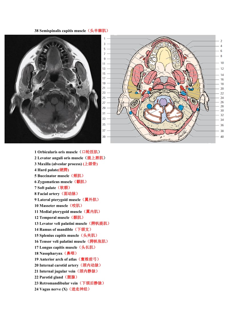鼻咽部断层解剖图.doc_第2页