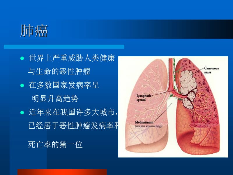 肺癌本科2.ppt_第1页