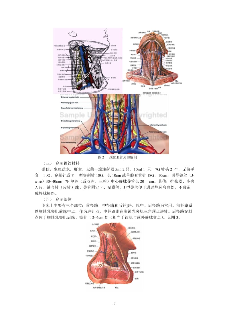 中心静脉穿刺置管和测压.doc_第2页
