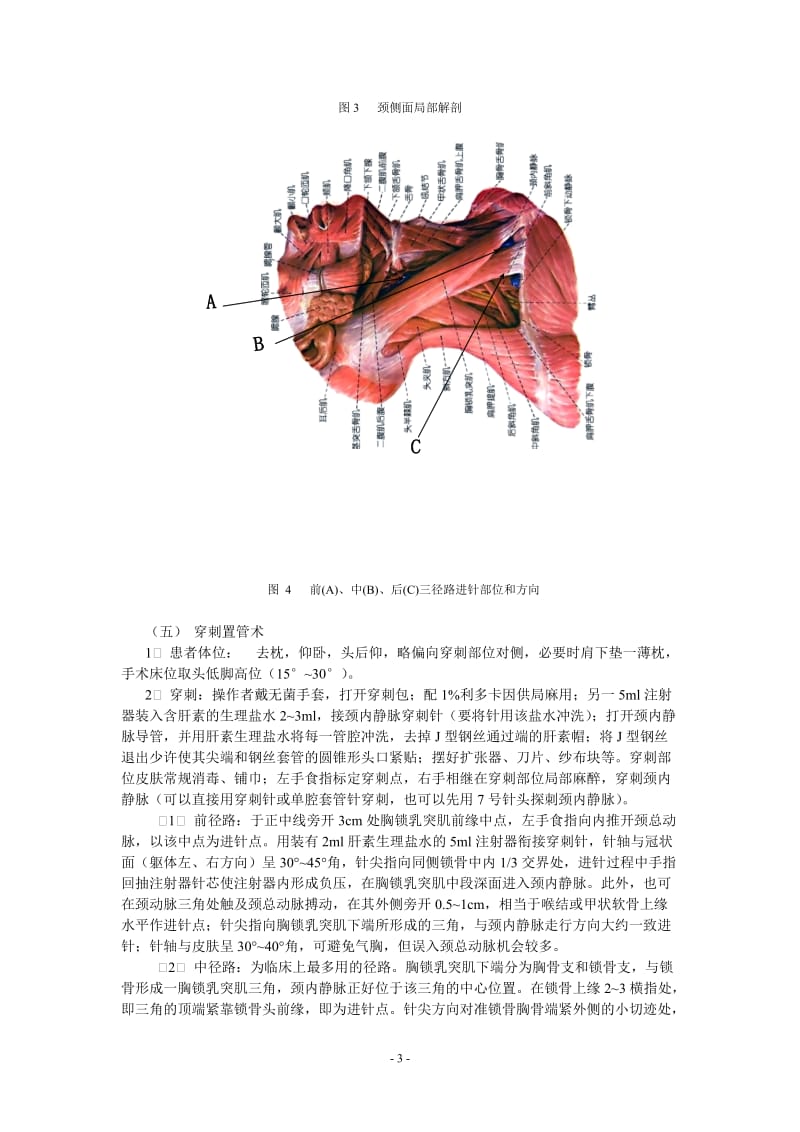 中心静脉穿刺置管和测压.doc_第3页