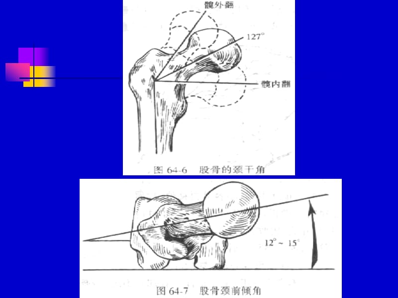 下肢骨折牵引图片2.ppt_第3页