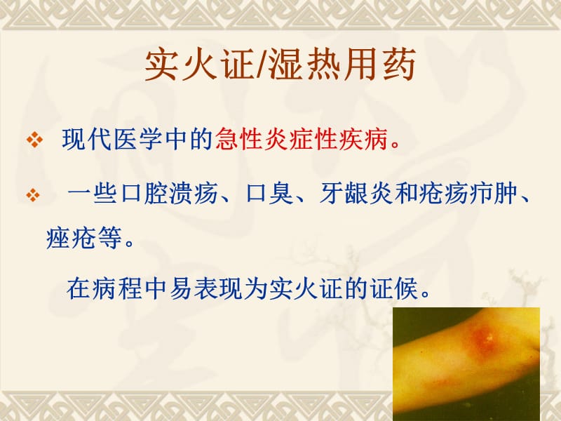 实火证用药.ppt_第2页