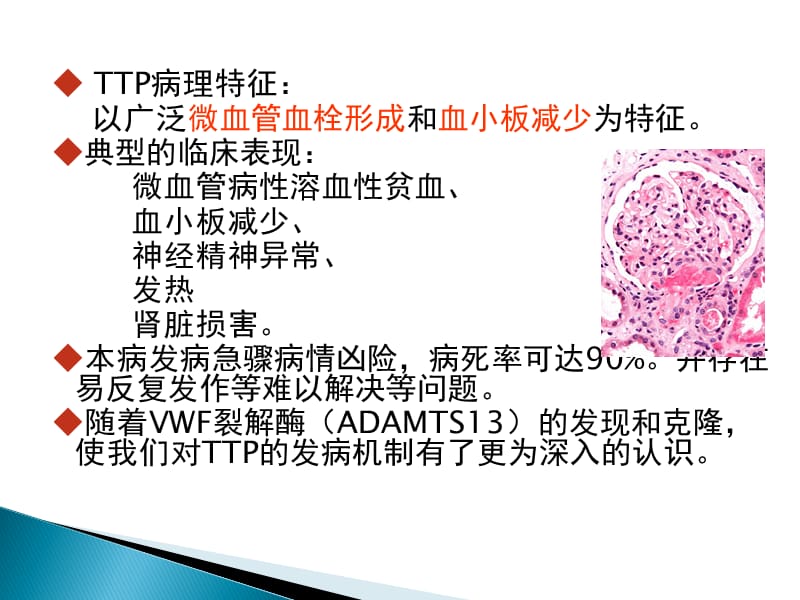 TTP诊治住院医师规培.ppt_第2页